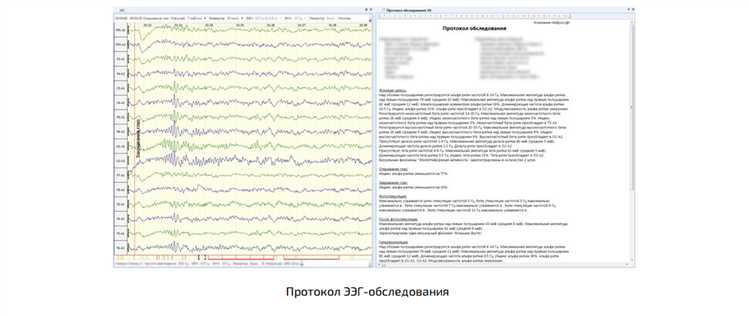 Что такое ээг для справки в гибдд